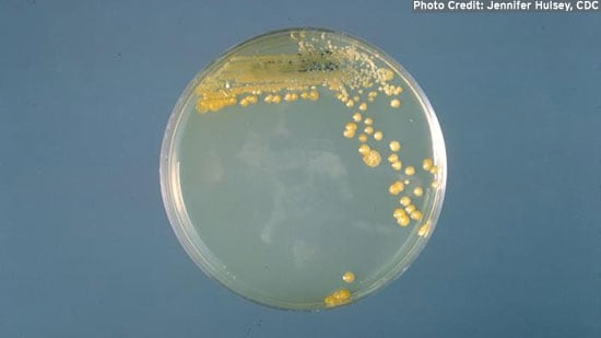 Cronobacter sakazakii developing on a petri dish.